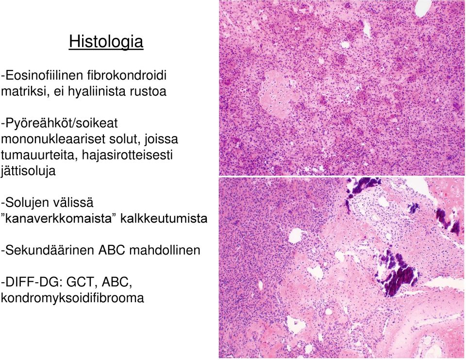 hajasirotteisesti jättisoluja -Solujen välissä kanaverkkomaista