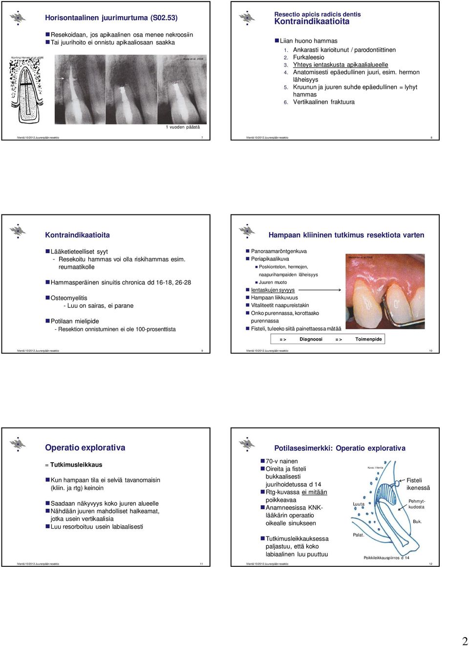 Ankarasti karioitunut / parodontiittinen 2. Furkaleesio 3. Yhteys ientaskusta apikaalialueelle 4. Anatomisesti epäedullinen juuri, esim. hermon läheisyys 5.