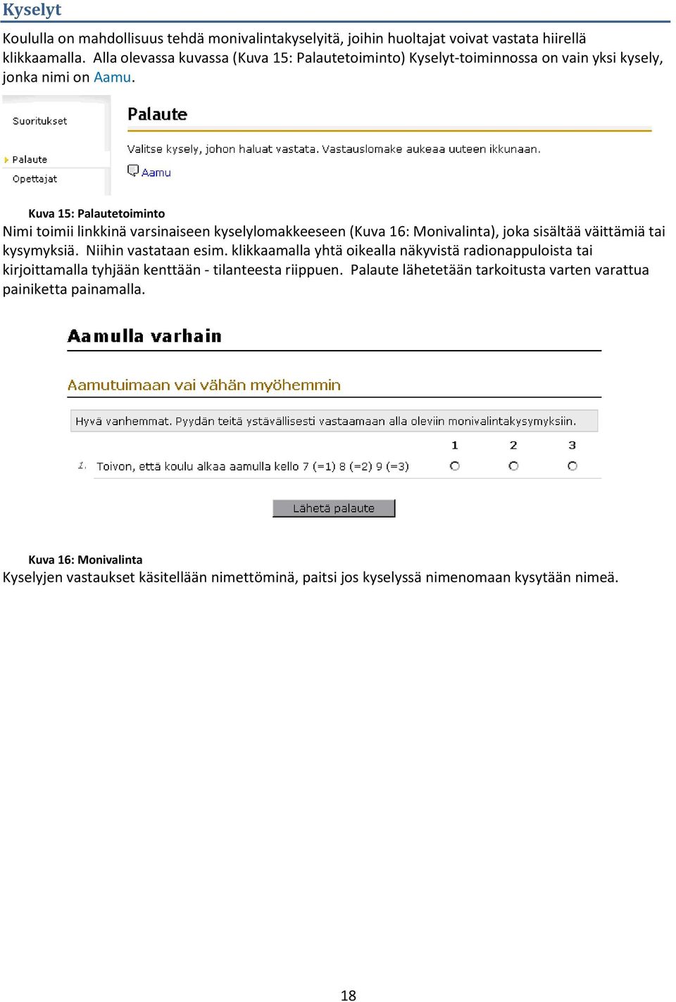 Kuva 15: Palautetoiminto Nimi toimii linkkinä varsinaiseen kyselylomakkeeseen (Kuva 16: Monivalinta), joka sisältää väittämiä tai kysymyksiä. Niihin vastataan esim.