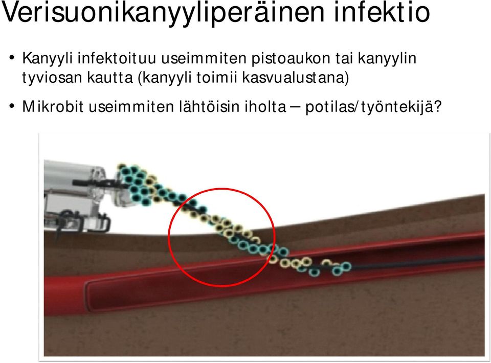 tyviosan kautta (kanyyli toimii kasvualustana)