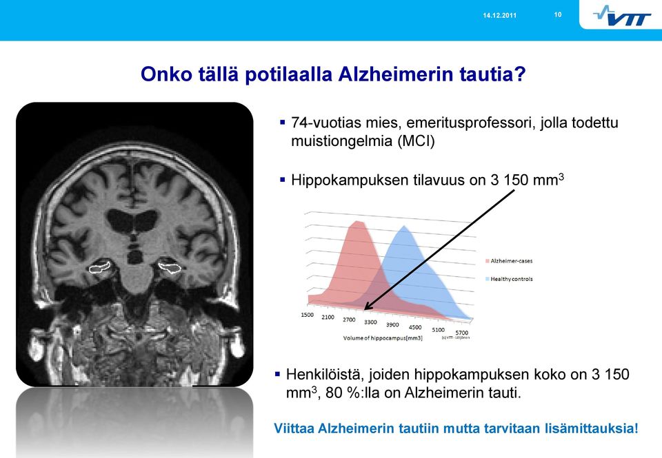 Hippokampuksen tilavuus on 3 150 mm 3 Henkilöistä, joiden hippokampuksen