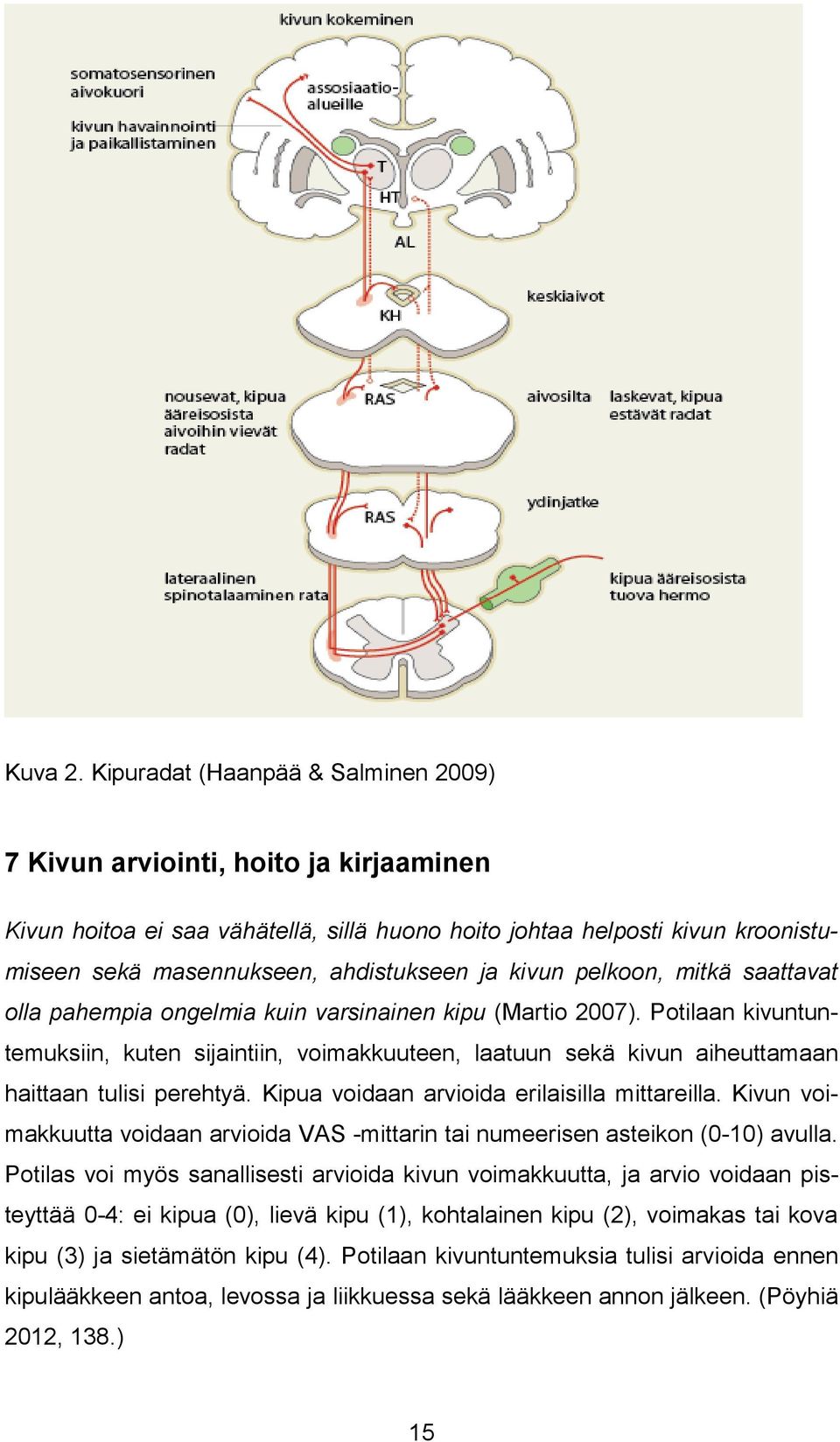 kivun pelkoon, mitkä saattavat olla pahempia ongelmia kuin varsinainen kipu (Martio 2007).