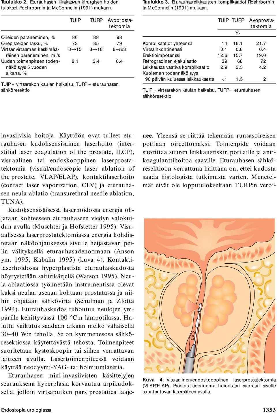 4 näköisyys 5 vuoden aikana, % TUIP = virtsarakon kaulan halkaisu, TURP = eturauhasen sähköresektio Taulukko 3. Eturauhasleikkausten komplikaatiot Roehrbornin ja McConnelin (1991) mukaan.