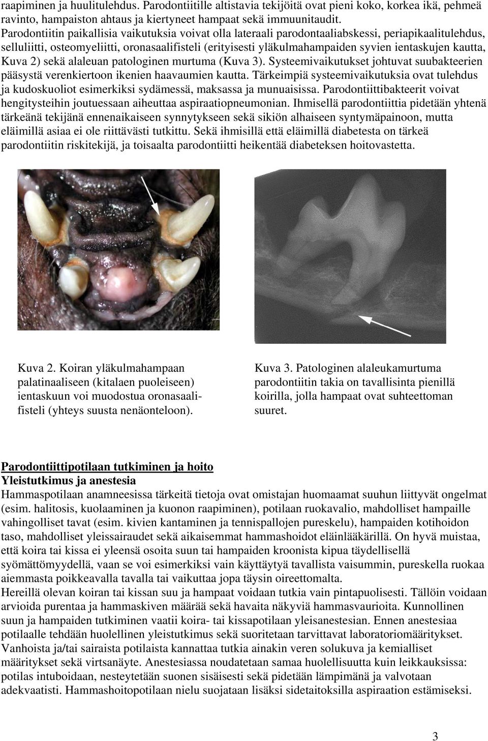ientaskujen kautta, Kuva 2) sekä alaleuan patologinen murtuma (Kuva 3). Systeemivaikutukset johtuvat suubakteerien pääsystä verenkiertoon ikenien haavaumien kautta.