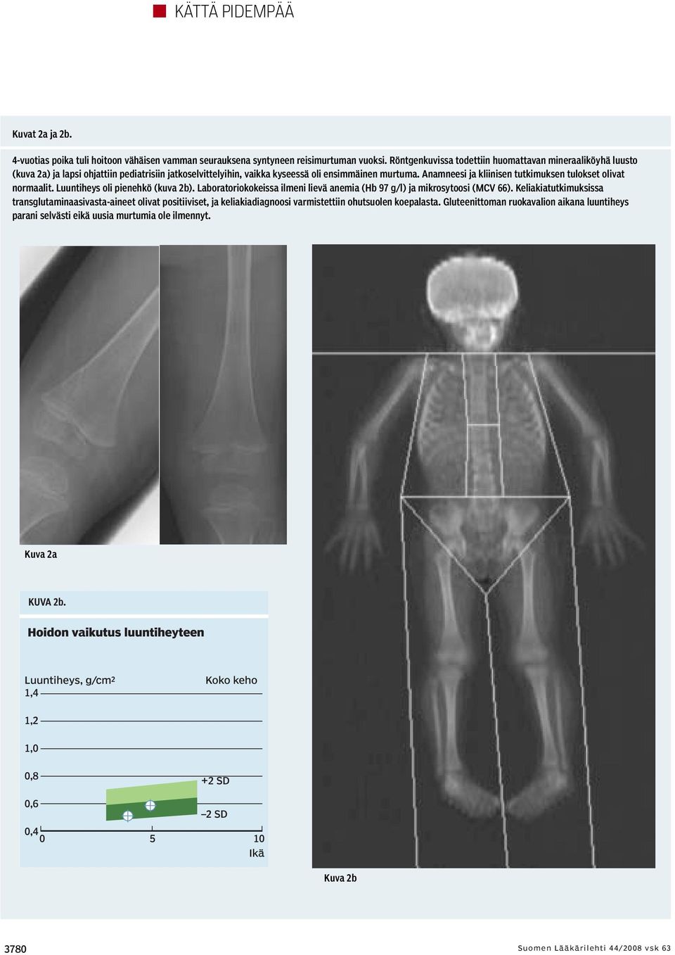 Anamneesi ja kliinisen tutkimuksen tulokset olivat normaalit. Luuntiheys oli pienehkö (kuva 2b). Laboratoriokokeissa ilmeni lievä anemia (Hb 97 g/l) ja mikrosytoosi (MCV 66).