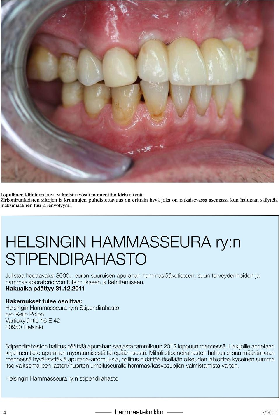 HELSINGIN HAMMASSEURA ry:n STIPENDIRAHASTO Julistaa haettavaksi 3000,- euron suuruisen apurahan hammaslääketieteen, suun terveydenhoidon ja hammaslaboratoriotyön tutkimukseen ja kehittämiseen.