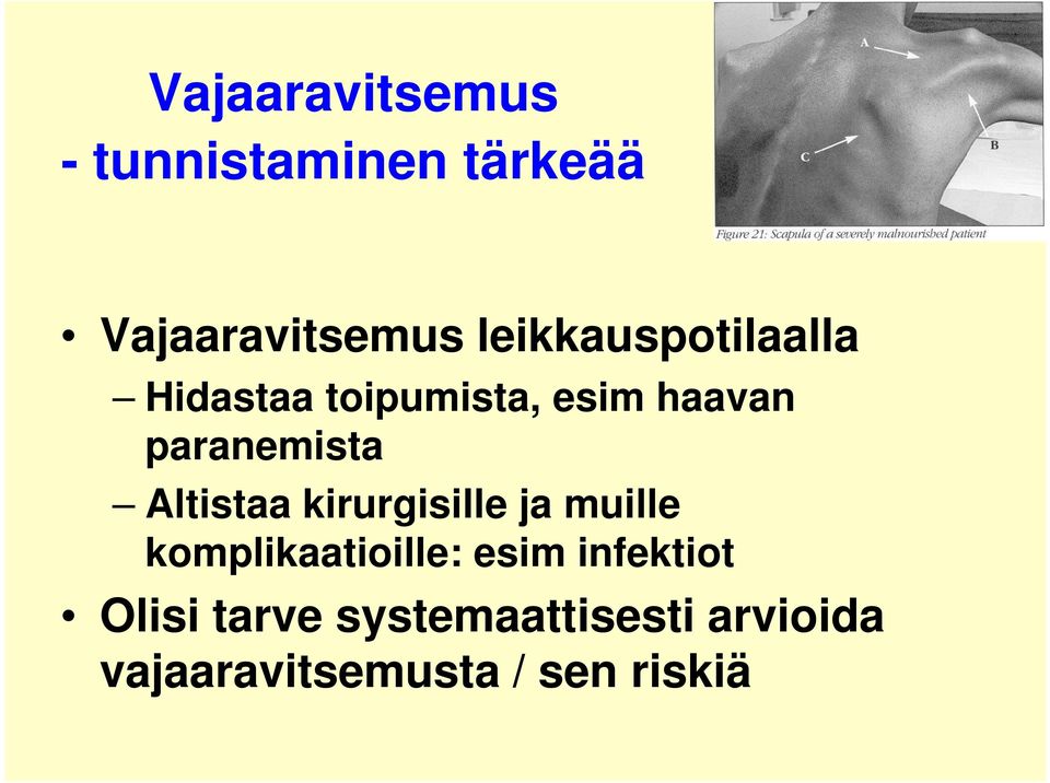 Altistaa kirurgisille ja muille komplikaatioille: esim