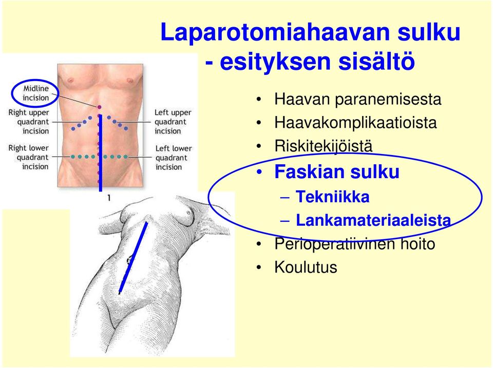 Riskitekijöistä Faskian sulku Tekniikka