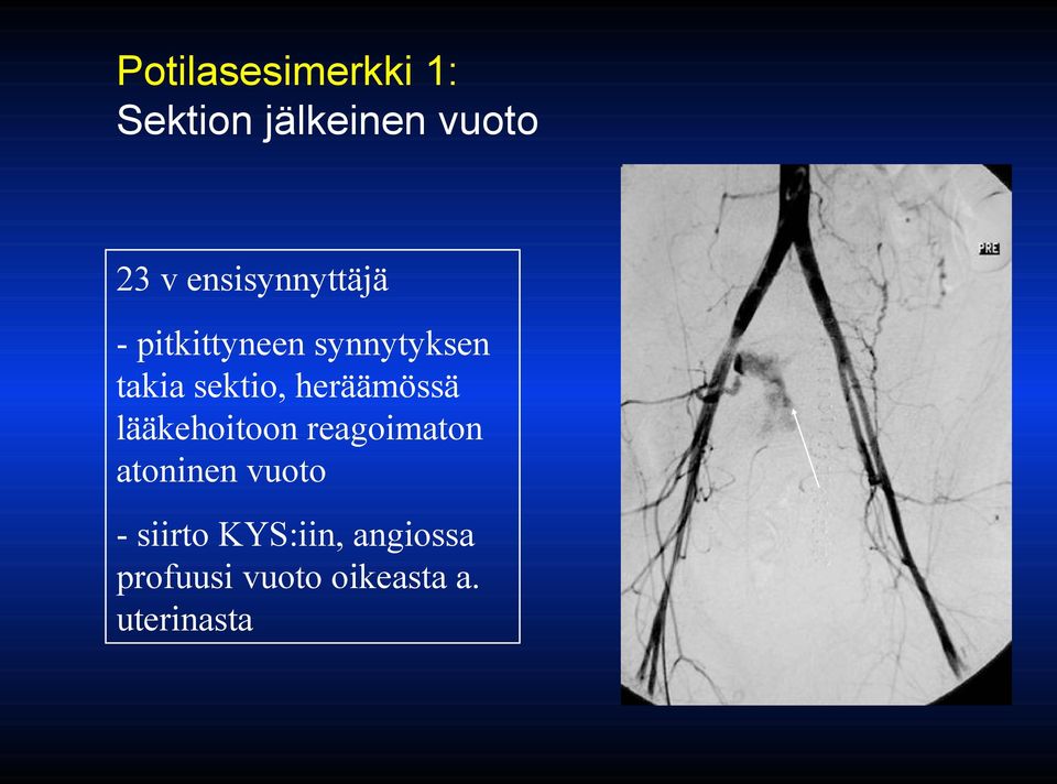 sektio, heräämössä lääkehoitoon reagoimaton atoninen