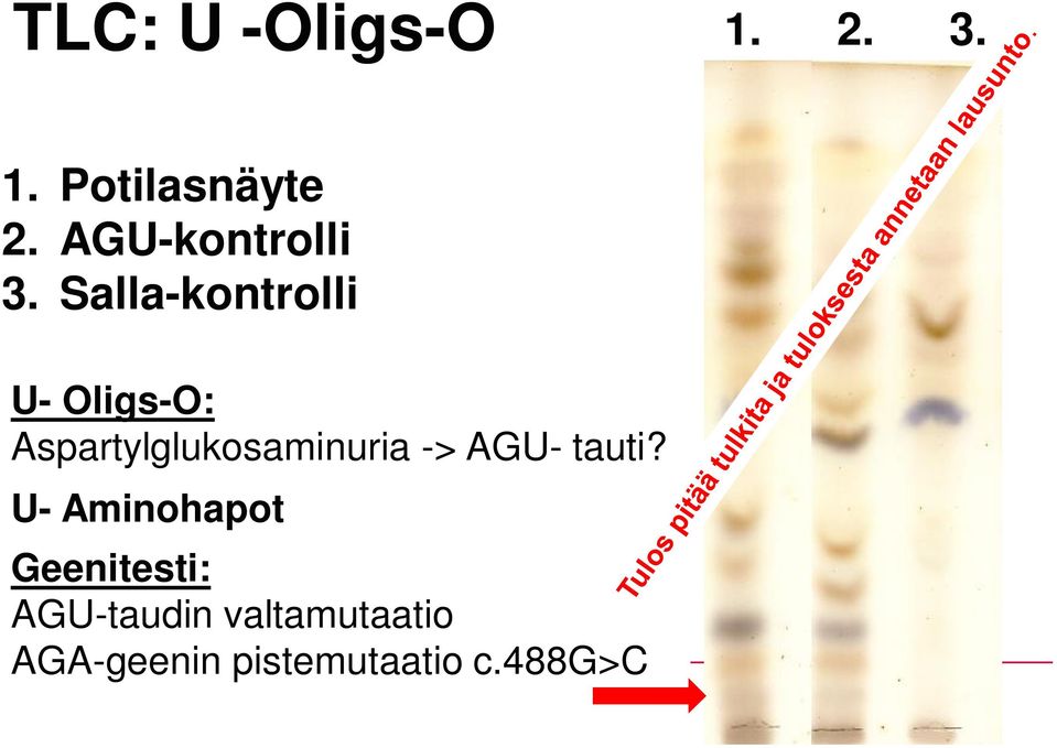 Salla-kontrolli U- Oligs-O: Aspartylglukosaminuria ->