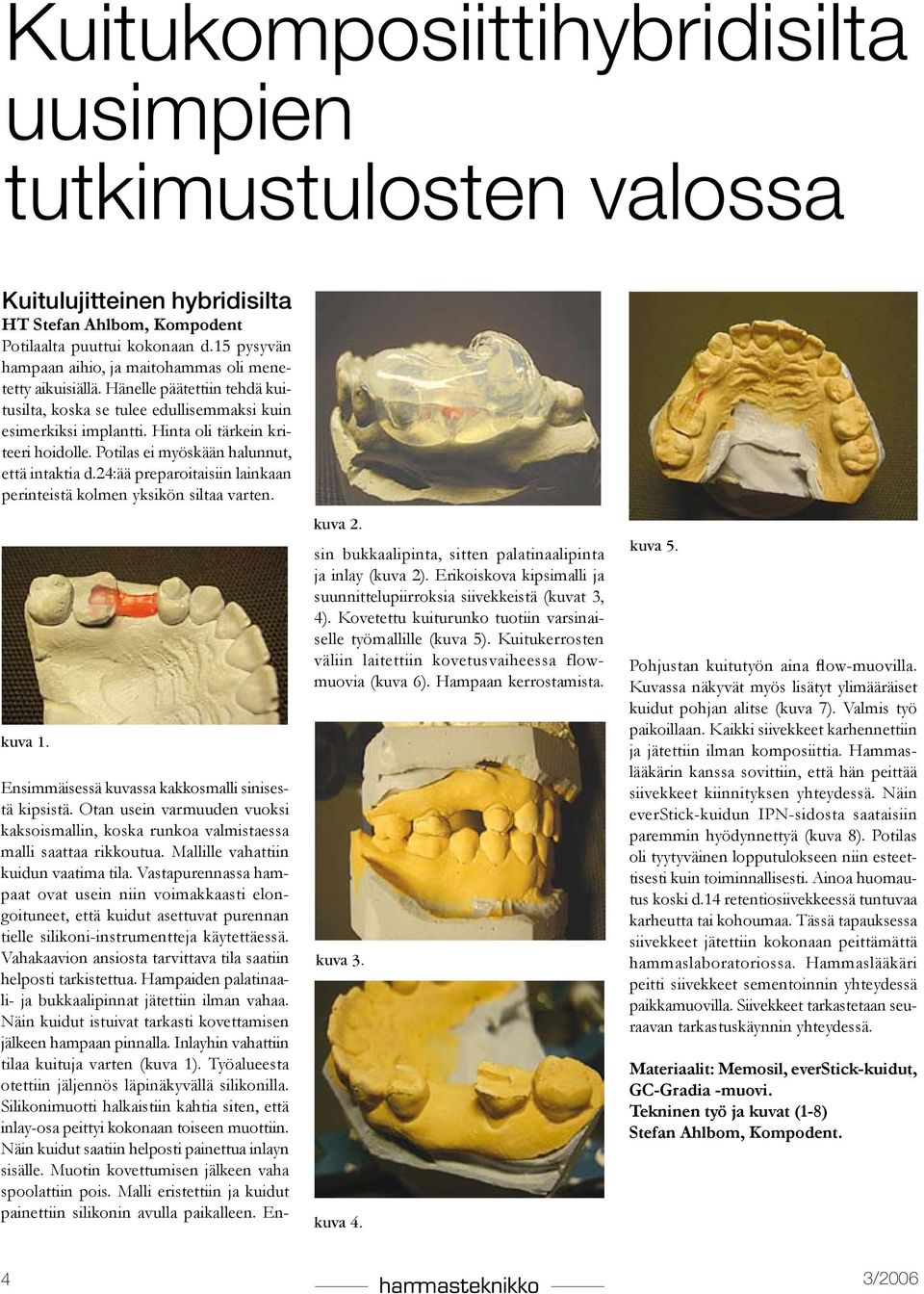Potilas ei myöskään halunnut, että intaktia d.24:ää preparoitaisiin lainkaan perinteistä kolmen yksikön siltaa varten. Ensimmäisessä kuvassa kakkosmalli sinisestä kipsistä.