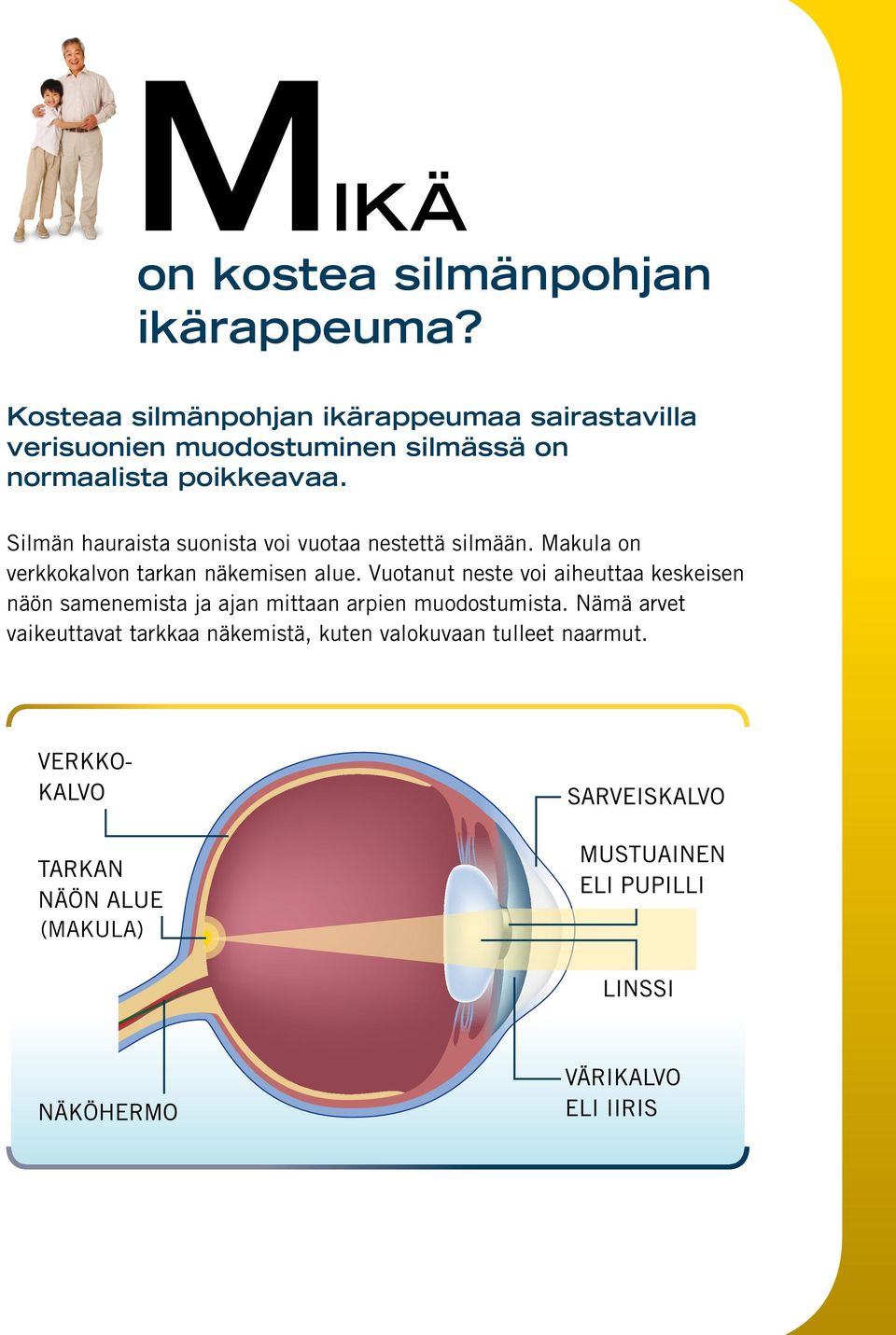 poikkeavaa. Silmän hauraista suonista voi vuotaa nestettä silmään.