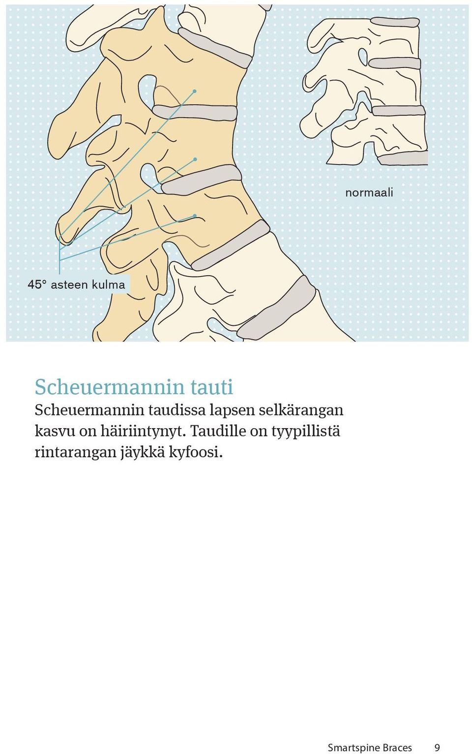 kasvu on häiriintynyt.