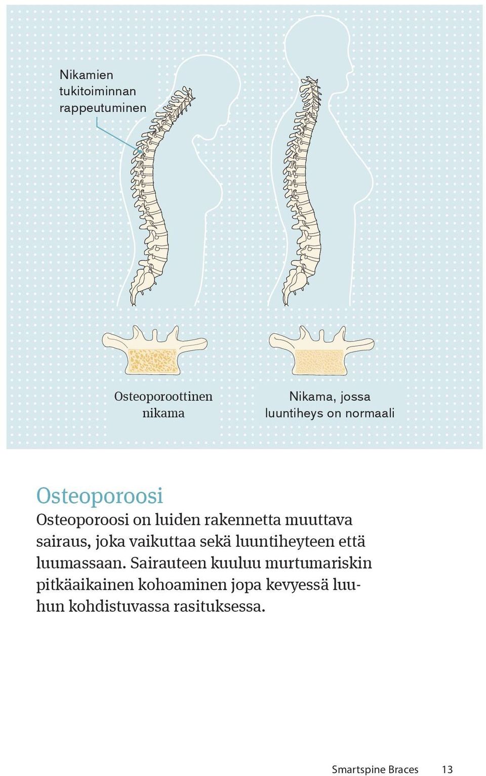 sairaus, joka vaikuttaa sekä luuntiheyteen että luumassaan.