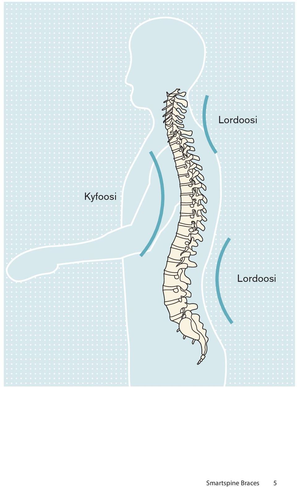 Smartspine