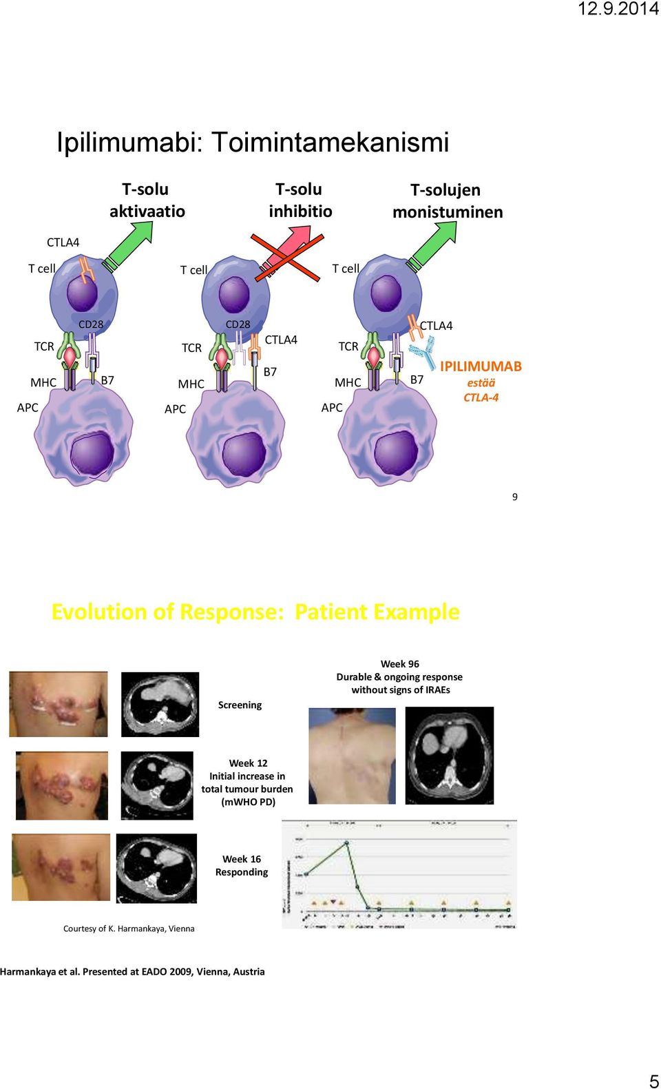 Example Screening Week 96 Durable & ongoing response without signs of IRAEs Week 12 Initial increase in total tumour