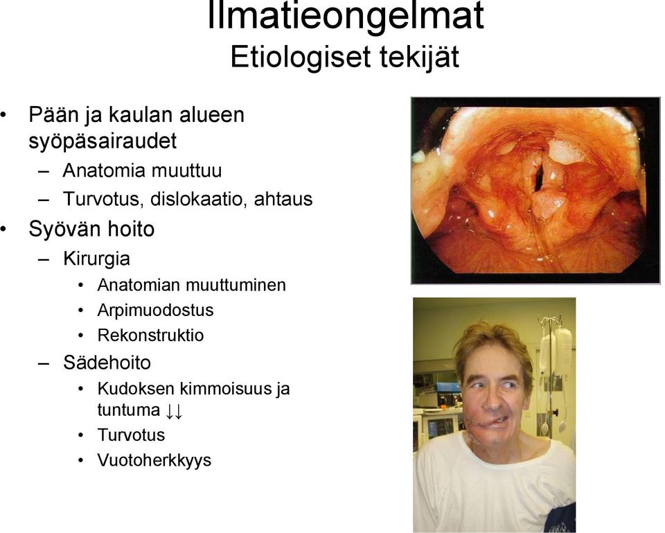 Arpimuodostus Rekonstruktio Sädehoito Kudoksen kimmoisuus ja