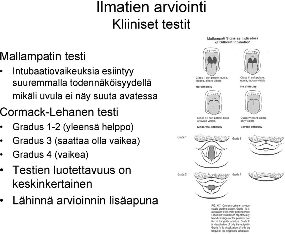 Cormack-Lehanen testi Gradus 1-2 (yleensä helppo) Gradus 3 (saattaa olla