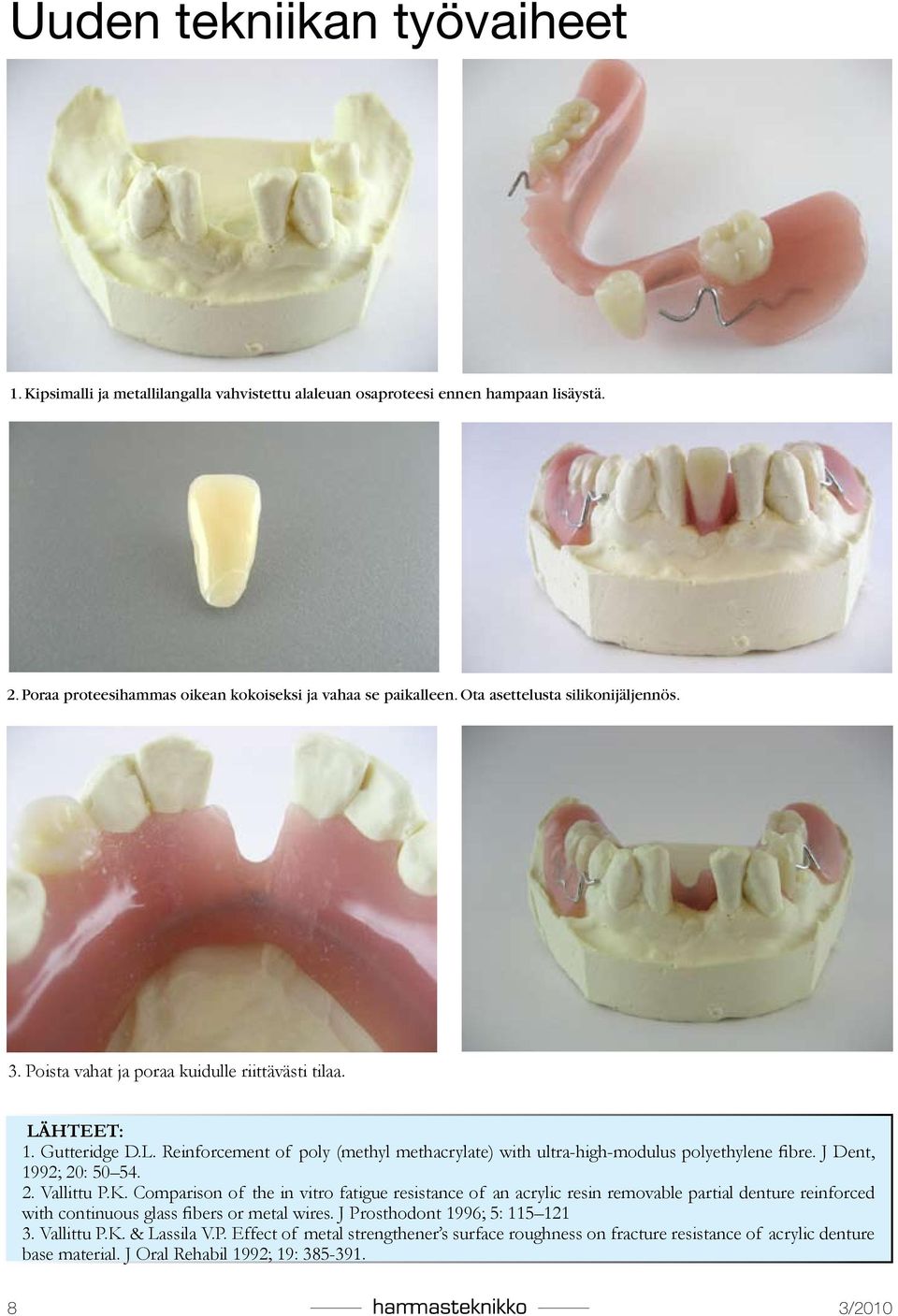 J Dent, 1992; 20: 50 54. 2. Vallittu P.K. Comparison of the in vitro fatigue resistance of an acrylic resin removable partial denture reinforced with continuous glass fibers or metal wires.