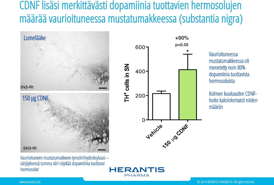 05# 150 μg CDNF TH + cells in SN 400 200 Vaurioituneessa mustatumakkeessa oli menetetty noin 80% dopamiinia tuottavista
