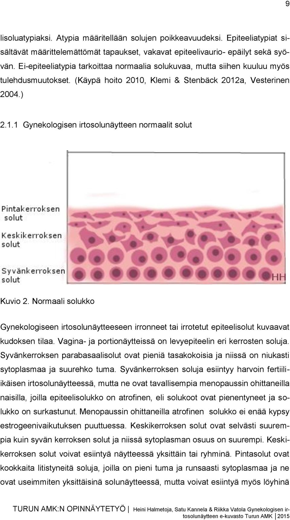 Normaali solukko Gynekologiseen irtosolunäytteeseen irronneet tai irrotetut epiteelisolut kuvaavat kudoksen tilaa. Vagina- ja portionäytteissä on levyepiteelin eri kerrosten soluja.
