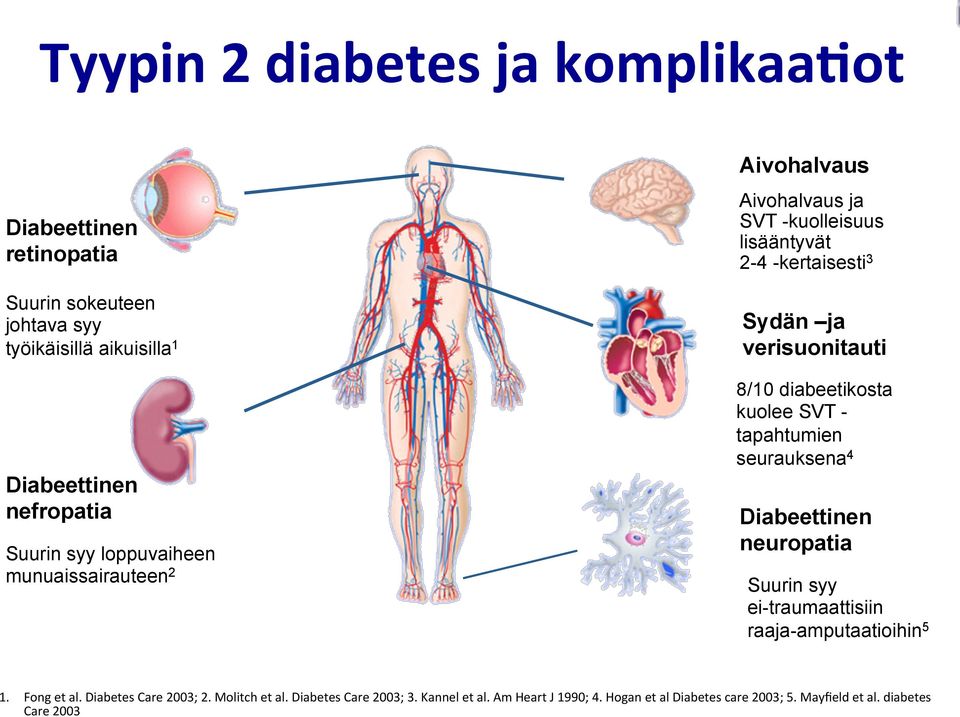 mortality SVT -kuolleisuus and stroke 3 lisääntyvät 2-4 -kertaisesti 3 Sydän ja Cardiovascular verisuonitauti disease 8/10 diabeetikosta kuolee SVT - tapahtumien seurauksena 4 Diabetic neuropathy