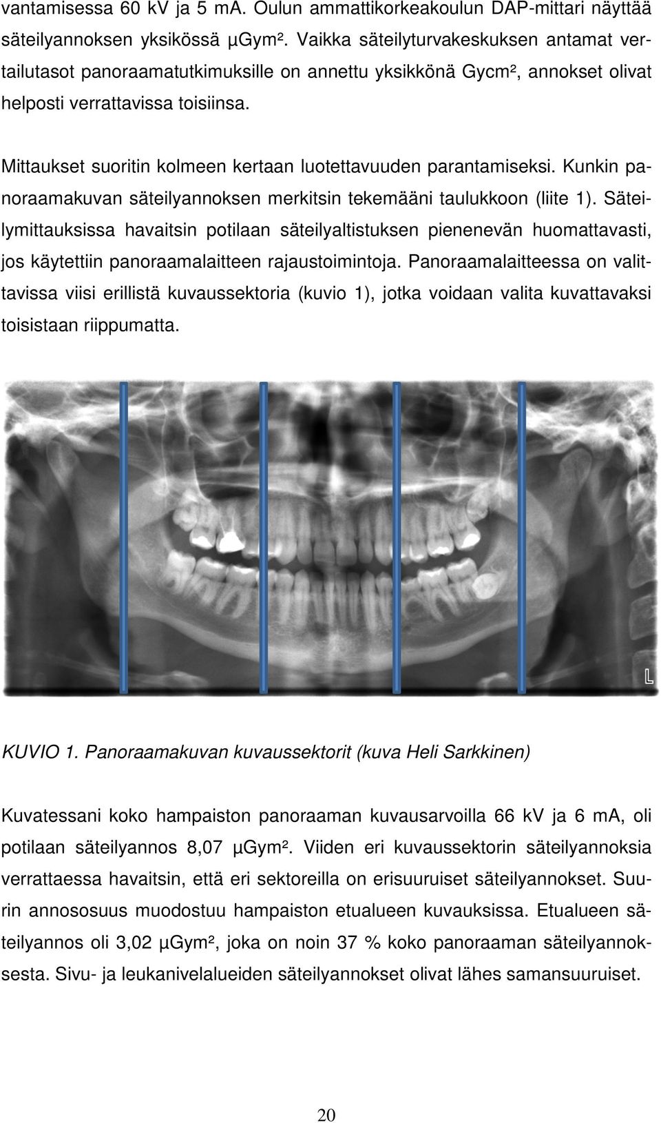 Mittaukset suoritin kolmeen kertaan luotettavuuden parantamiseksi. Kunkin panoraamakuvan säteilyannoksen merkitsin tekemääni taulukkoon (liite 1).