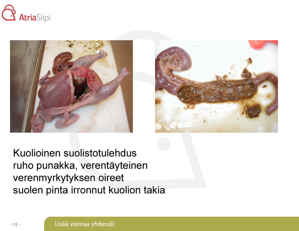 verenmyrkytyksen oireet suolen