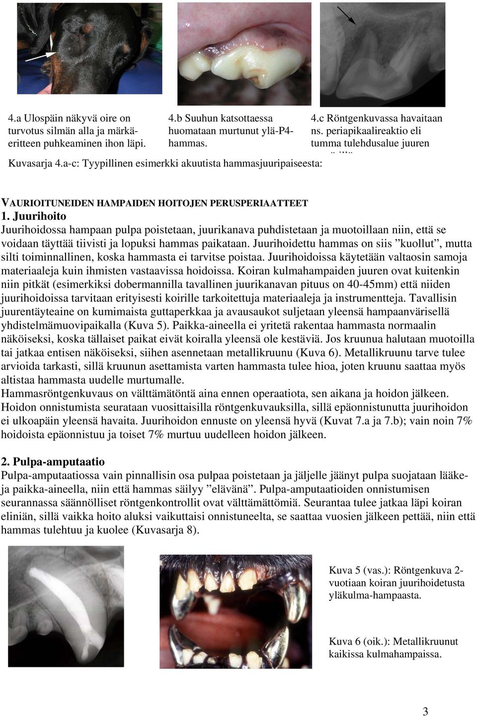 periapikaalireaktio eli tumma tulehdusalue juuren ympärillä VAURIOITUNEIDEN HAMPAIDEN HOITOJEN PERUSPERIAATTEET 1.