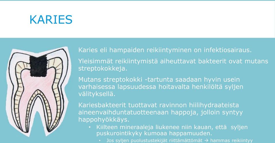 Kariesleesio (Lähde: Hammaslääkäriliitto) Kariesbakteerit tuottavat ravinnon hiilihydraateista aineenvaihduntatuotteenaan happoja, jolloin