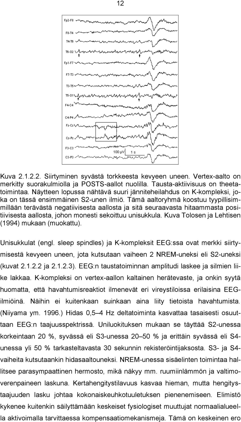 Tämä aaltoryhmä koostuu tyypillisimmillään terävästä negatiivisesta aallosta ja sitä seuraavasta hitaammasta positiivisesta aallosta, johon monesti sekoittuu unisukkula.