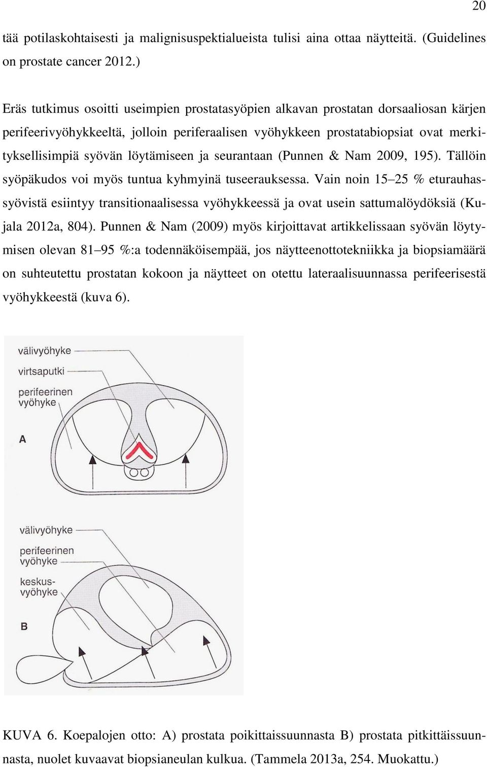 löytämiseen ja seurantaan (Punnen & Nam 2009, 195). Tällöin syöpäkudos voi myös tuntua kyhmyinä tuseerauksessa.