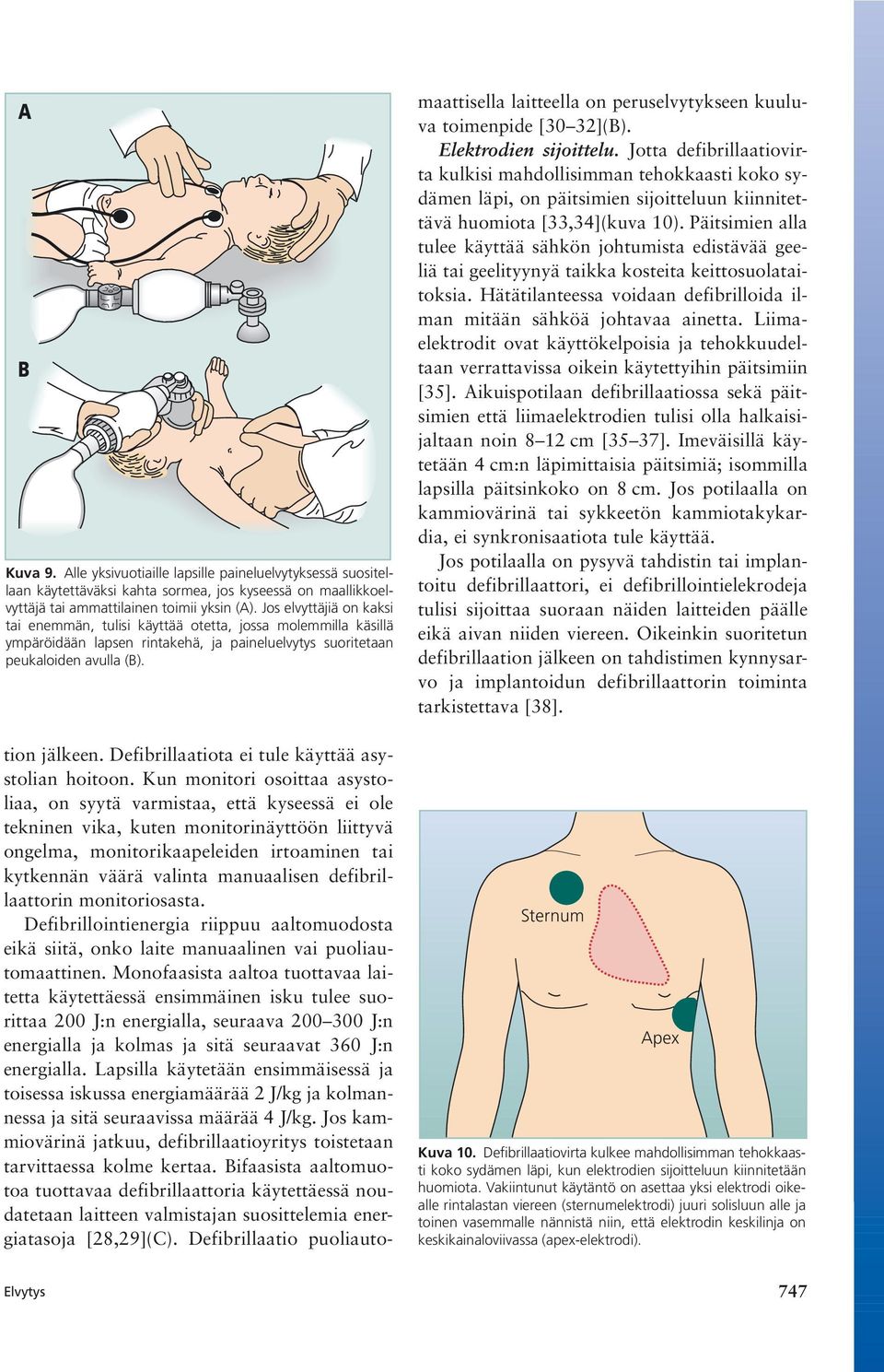 Defibrillaatiota ei tule käyttää asystolian hoitoon.