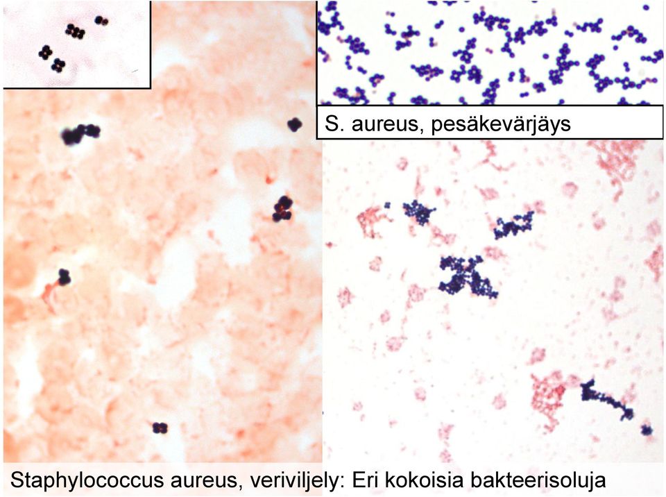 Staphylococcus