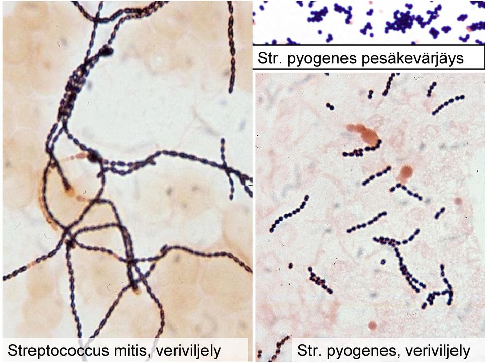 Streptococcus mitis,