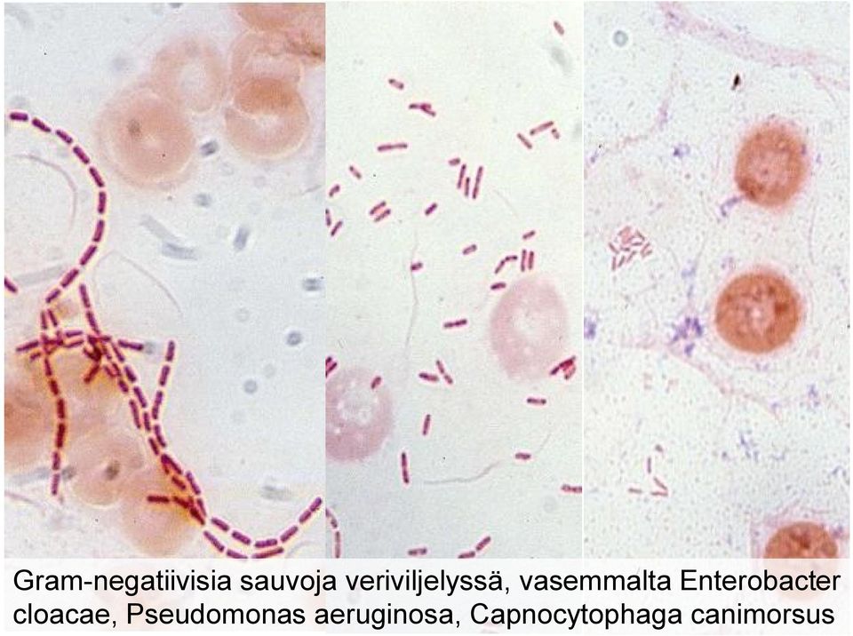 Enterobacter cloacae,