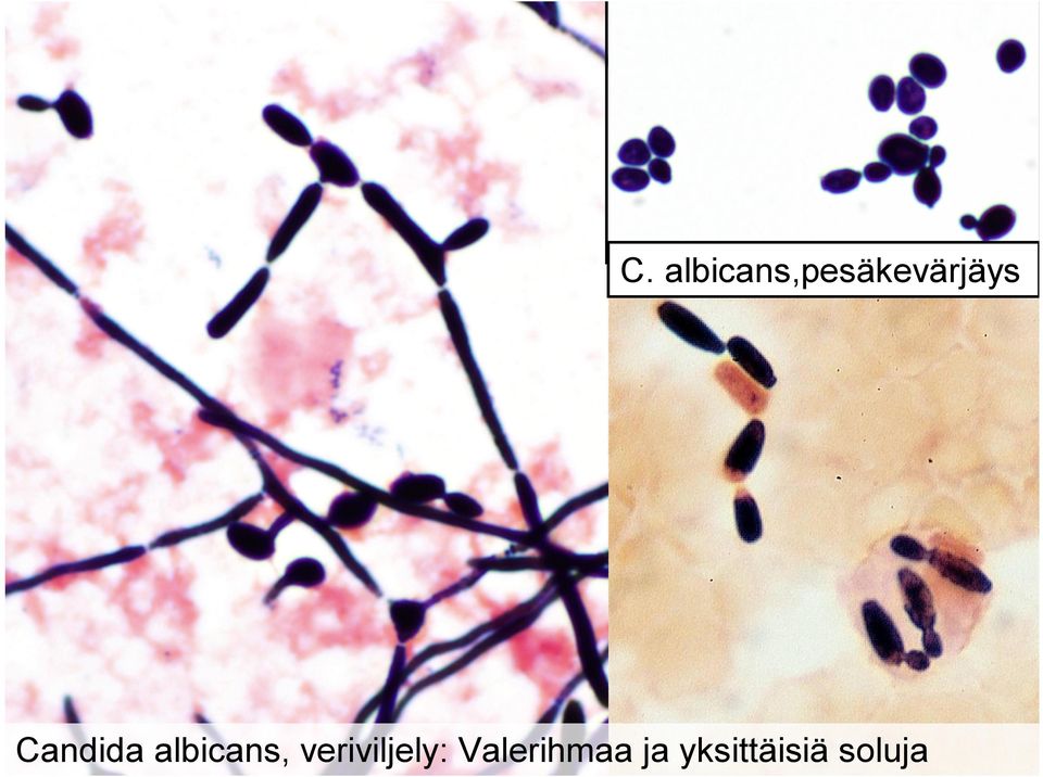 Candida albicans,