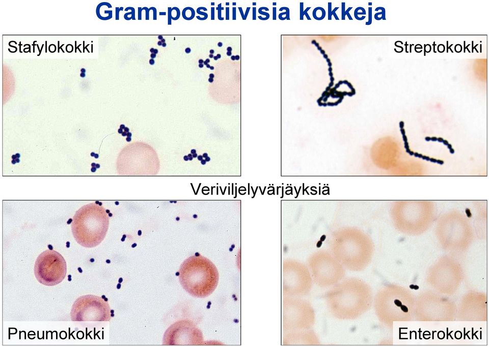 Streptokokki