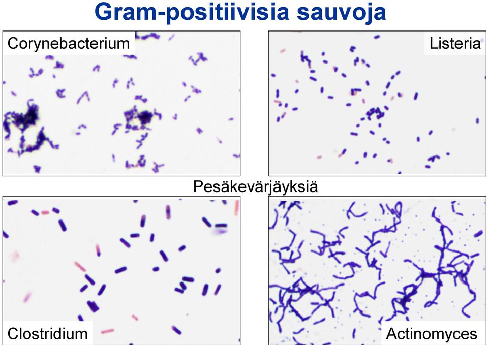 sauvoja Listeria