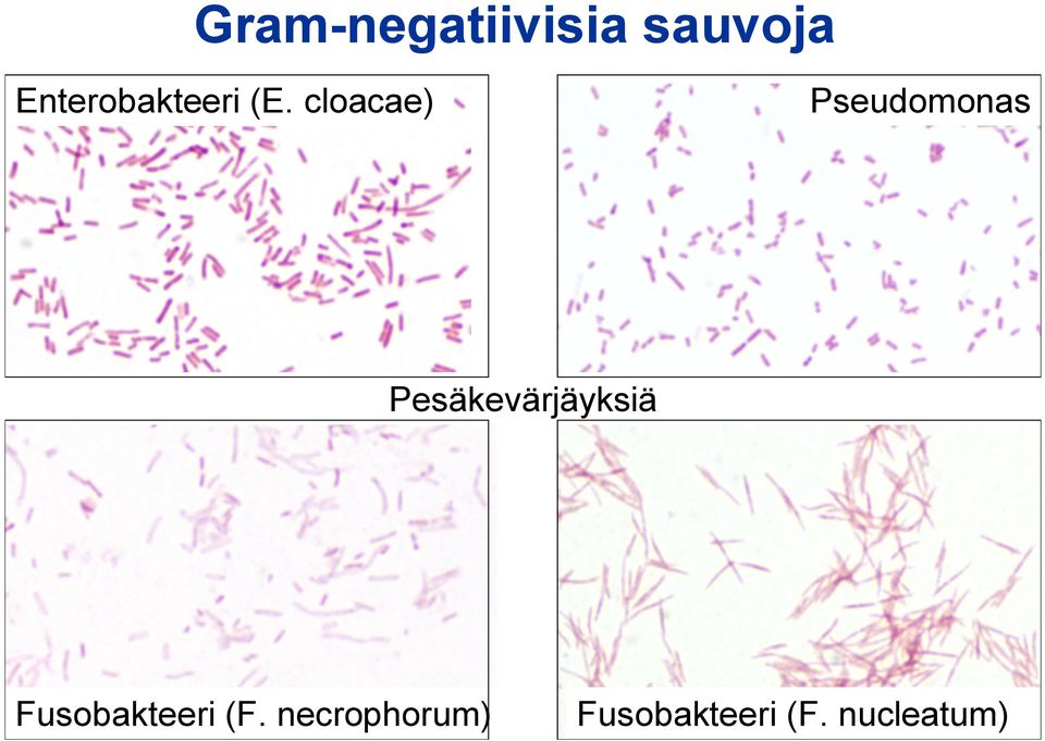 cloacae) Pseudomonas