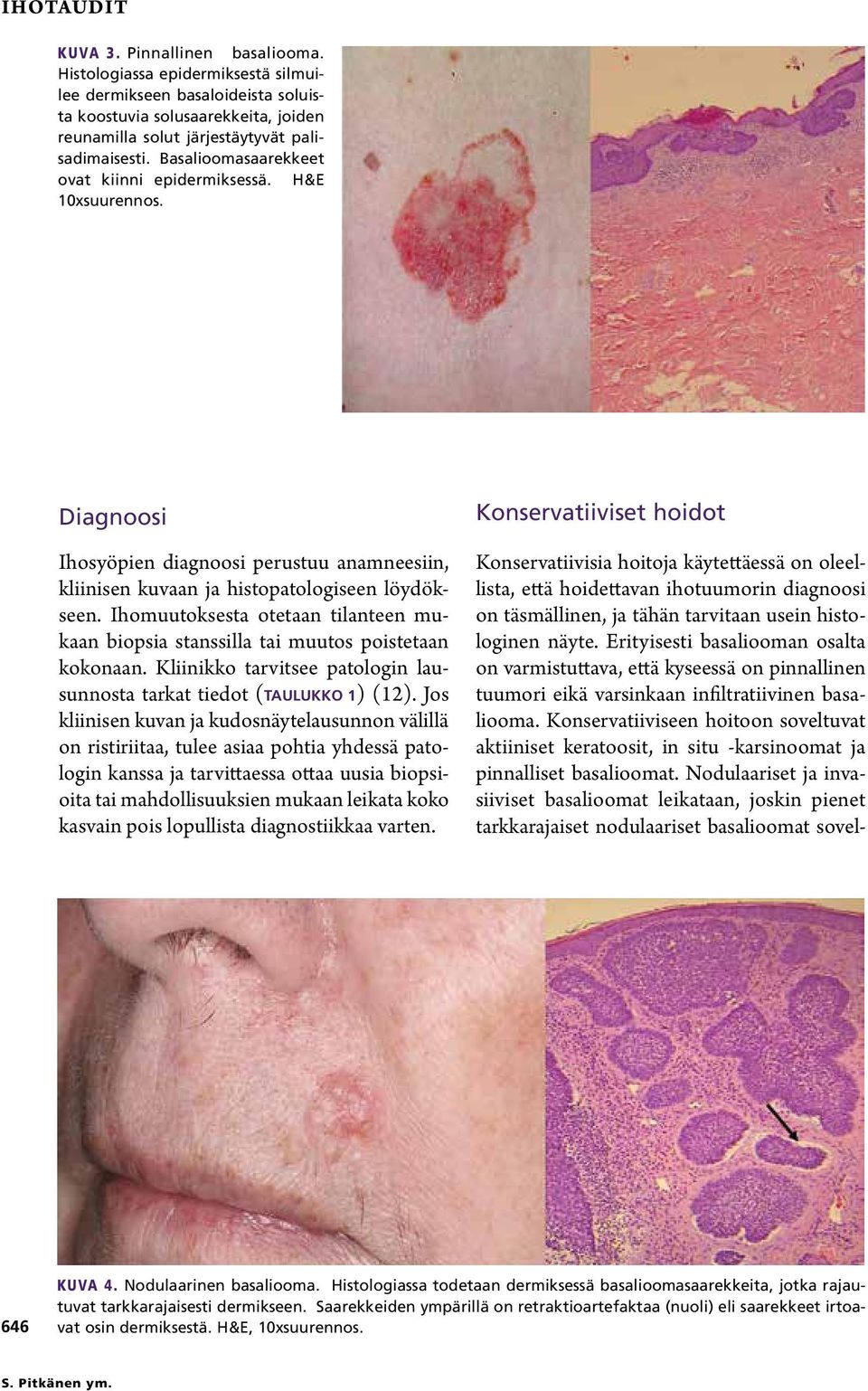 Ihomuutoksesta otetaan tilanteen mukaan biopsia stanssilla tai muutos poistetaan kokonaan. Kliinikko tarvitsee patologin lausunnosta tarkat tiedot (TAULUKKO 1) (12).