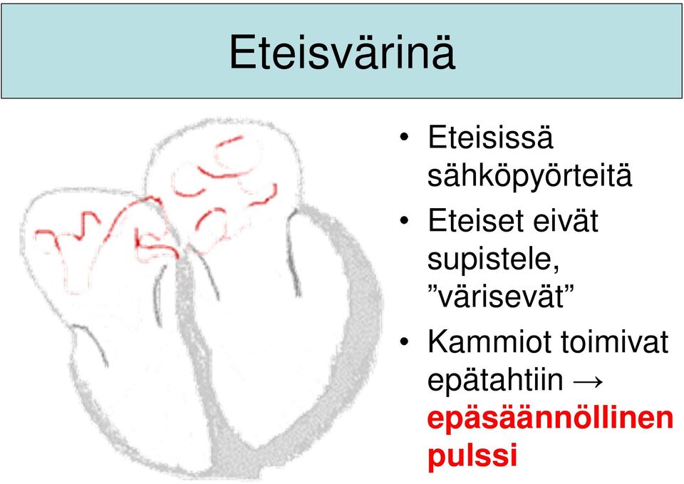 supistele, värisevät Kammiot