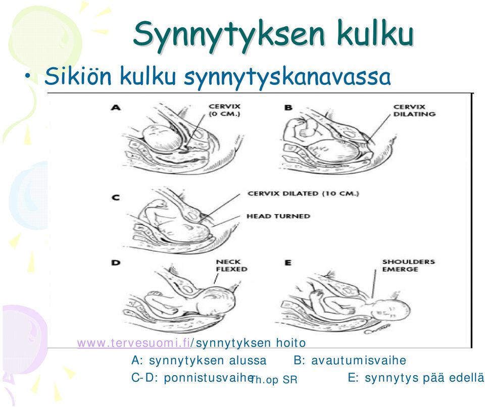 fi/synnytyksen hoito A: synnytyksen