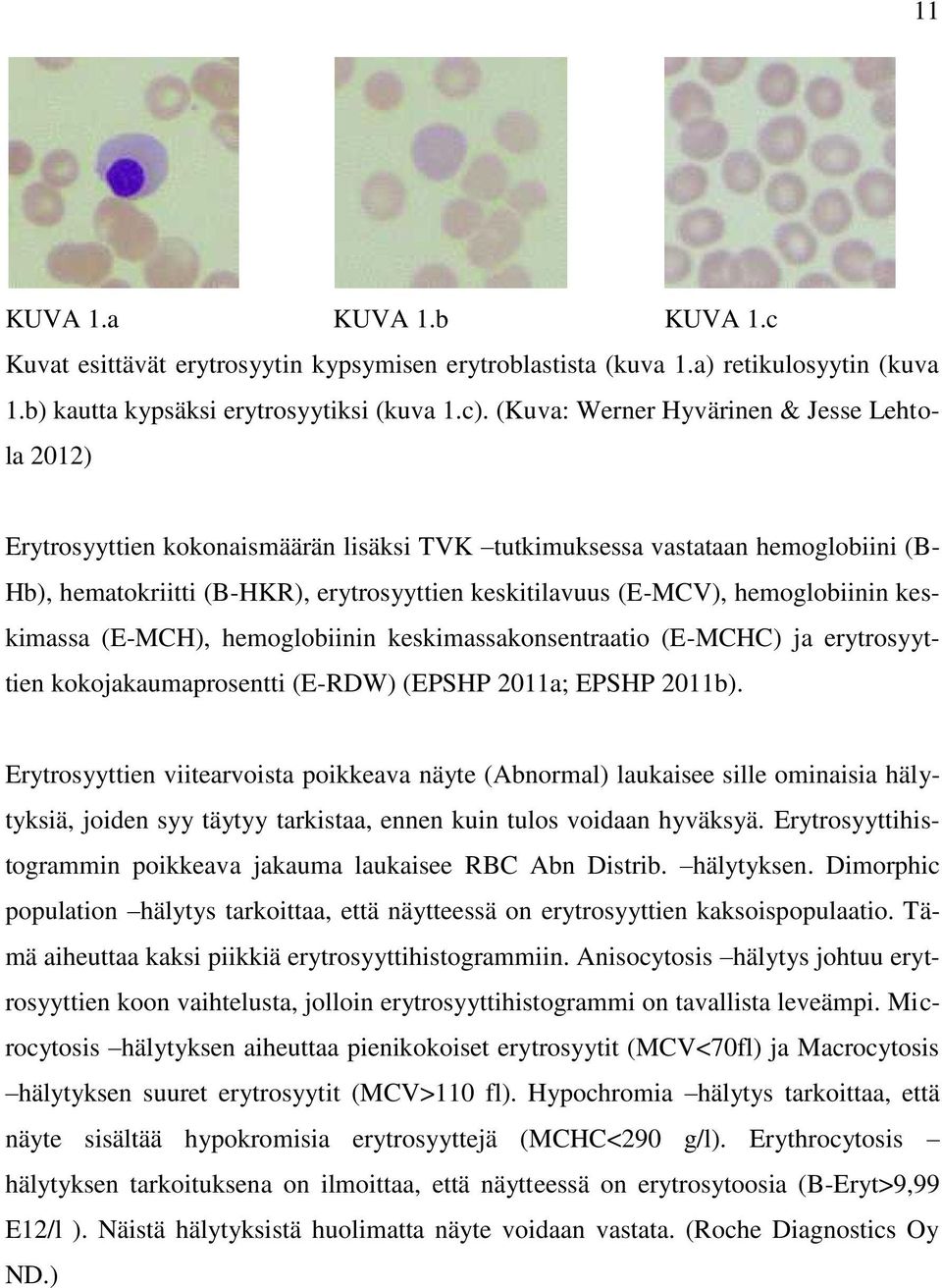 hemoglobiinin keskimassa (E -MCH), hemoglobiinin keskimassakonsentraatio (E -MCHC) ja erytrosyyttien kokojakaumaprosentti (E-RDW) (EPSHP 2011a; EPSHP 2011b).