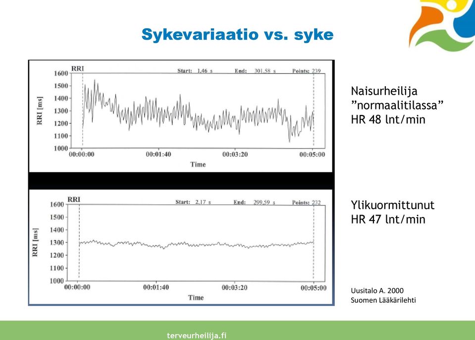 normaalitilassa HR 48 lnt/min