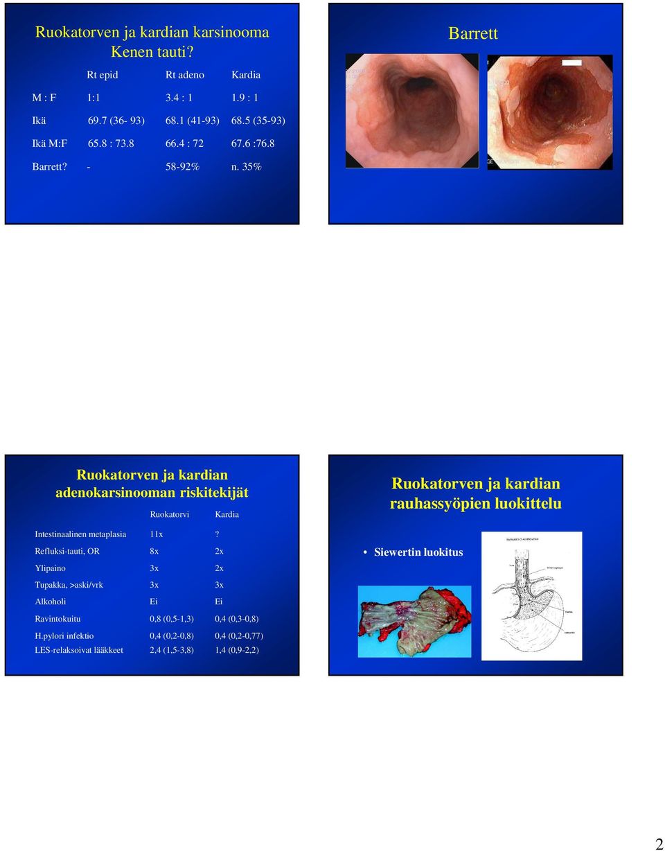 35% Ruokatorven ja kardian adenokarsinooman riskitekijät Ruokatorvi Intestinaalinen metaplasia 11x?