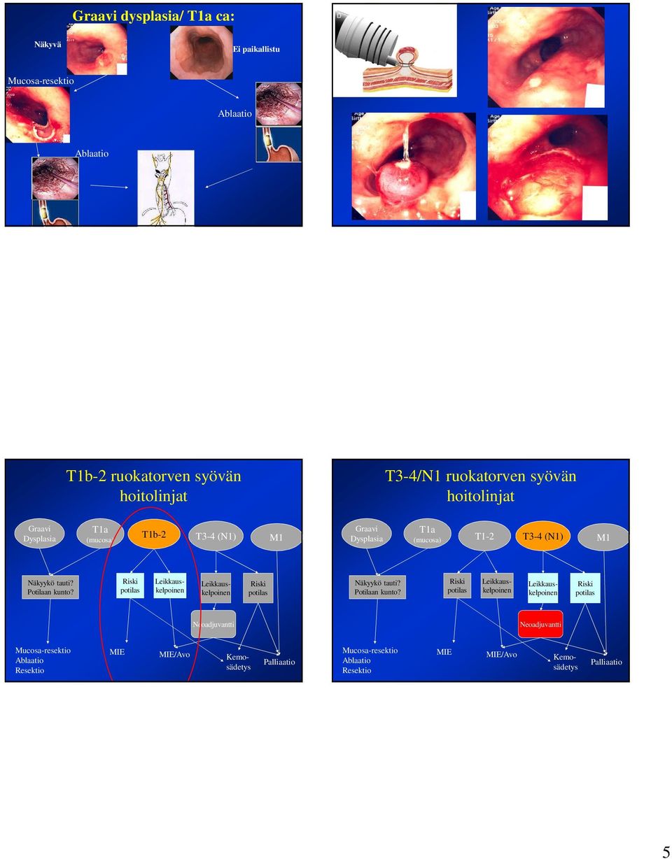 (mucosa) T1-2 T3-4 (N1) M1 Näkyykö tauti? Potilaan kunto?