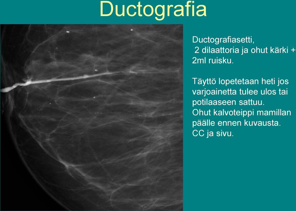 Täyttö lopetetaan heti jos varjoainetta tulee ulos