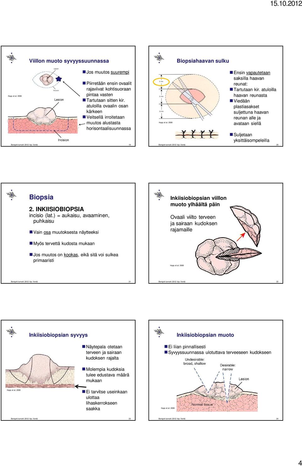 atuloilla haavan reunasta Viedään plastiasakset suljettuna haavan reunan alle ja avataan siellä Suljetaan yksittäisompeleilla 20 Biopsia 2. INKIISIOBIOPSIA incisio (lat.