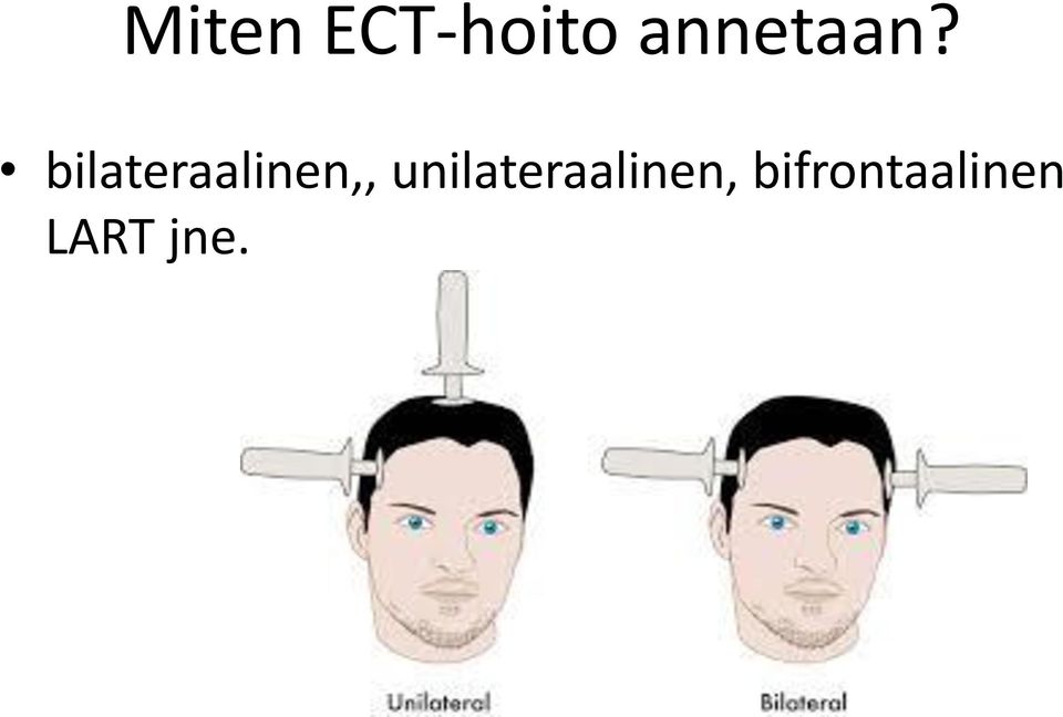 bilateraalinen,,